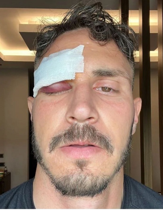 Geçmiş olsun Mert Çetin